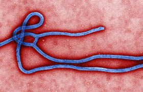 全澳拉响红色警报 致命“埃博拉病毒”兵临城下